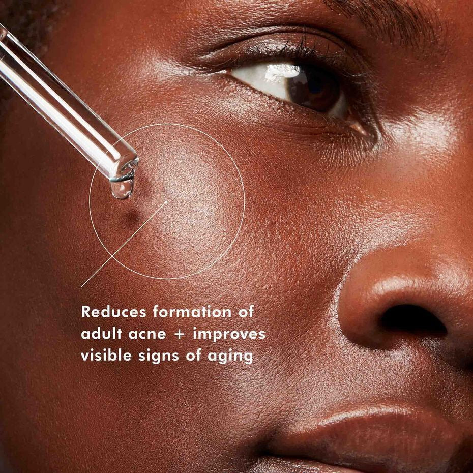SkinCeuticals Blemish + Age Defense Anti-Imperfection Serum